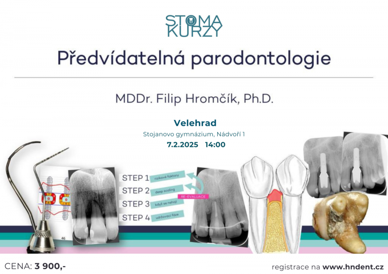 Předvídatelná parodontologie